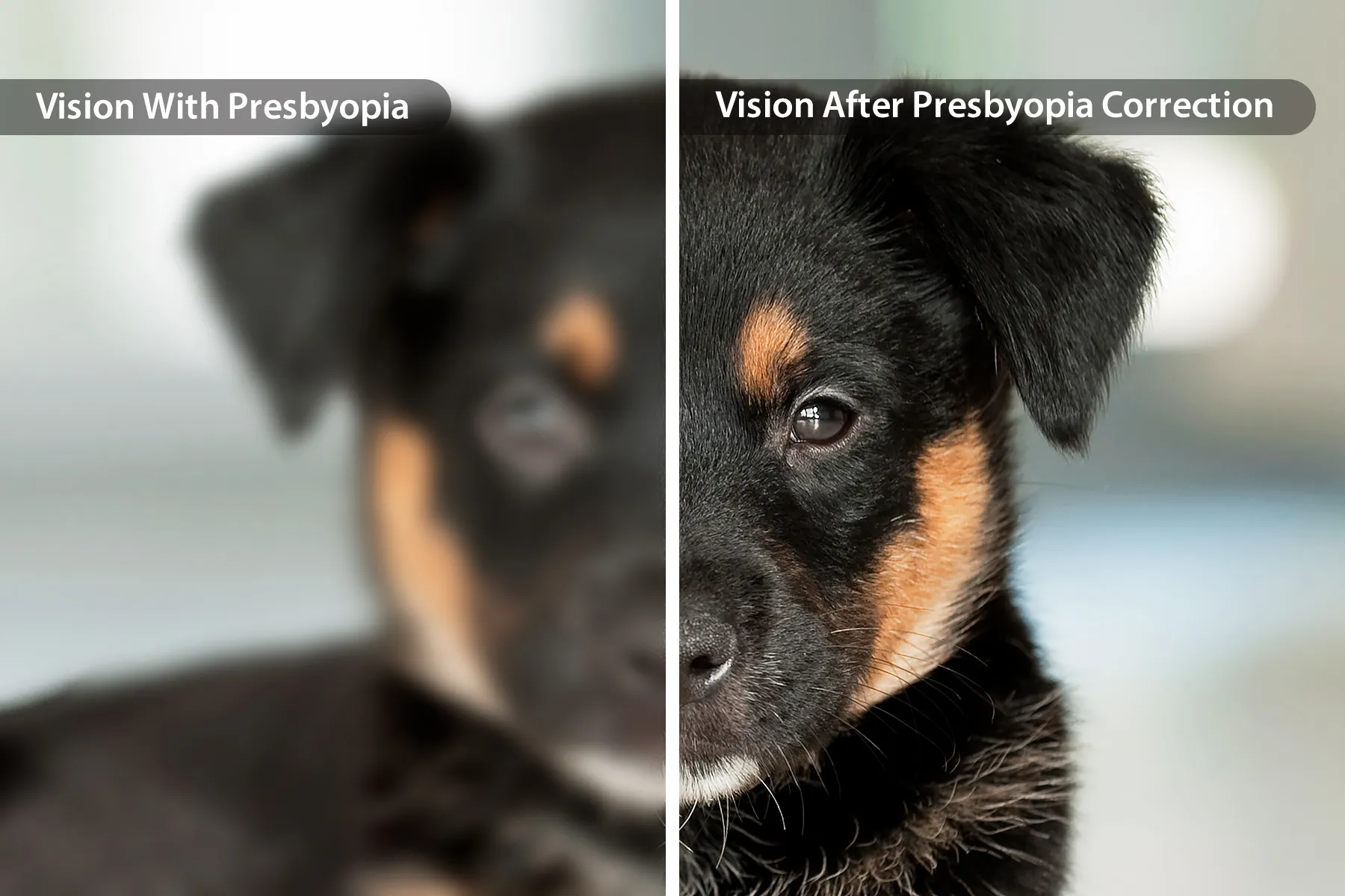 Presbiopia (Vista Cansada): Sintomas e Tratamentos